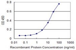 Monoclonal Anti-ALDH18A1 antibody produced in mouse clone 2B5, purified immunoglobulin, buffered aqueous solution
