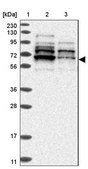 Anti-ZNF83 antibody produced in rabbit Prestige Antibodies® Powered by Atlas Antibodies, affinity isolated antibody, buffered aqueous glycerol solution