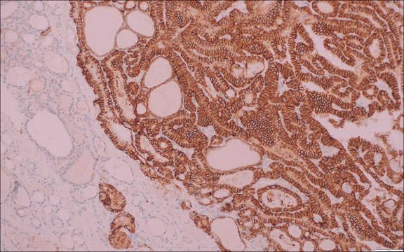 TROP2 (EP431) Rabbit Monoclonal Primary Antibody