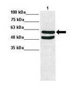 Anti-ALDH1B1 antibody produced in rabbit affinity isolated antibody