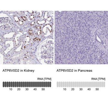 Anti-ATP6V0D2 antibody produced in rabbit Prestige Antibodies&#174; Powered by Atlas Antibodies, affinity isolated antibody, buffered aqueous glycerol solution