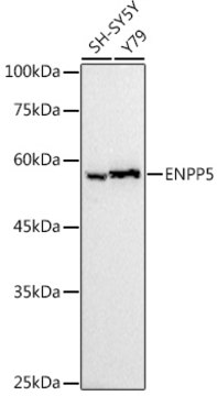 Anti-ENPP5 Antibody, clone 8I7C7, Rabbit Monoclonal