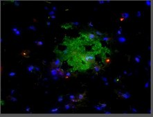 Anti-Aβ-42 Antibody, oligomeric (VIA) serum, from rabbit