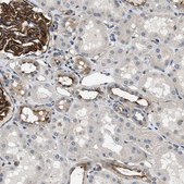 Anti-GPRC5B antibody produced in rabbit Prestige Antibodies® Powered by Atlas Antibodies, affinity isolated antibody, buffered aqueous glycerol solution