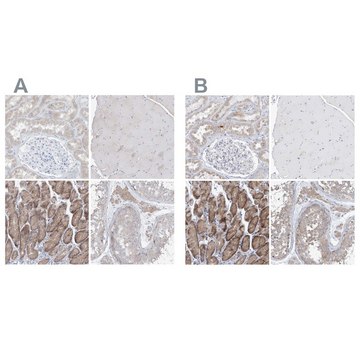 抗-UFL1 兔抗 Prestige Antibodies&#174; Powered by Atlas Antibodies, affinity isolated antibody, buffered aqueous glycerol solution, ab2