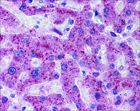 Anti-TMPRSS6 affinity isolated antibody