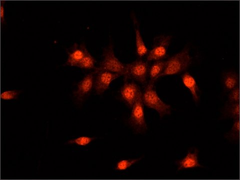 Anti-SMAD6 (N-terminal) antibody produced in rabbit ~1.0&#160;mg/mL, affinity isolated antibody