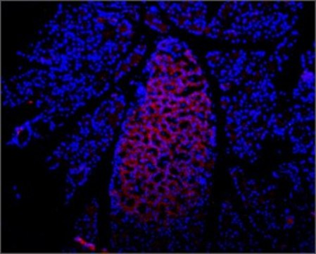 Anti-Purinergic Receptor P2X7 (extracellular) antibody produced in rabbit affinity isolated antibody, lyophilized powder