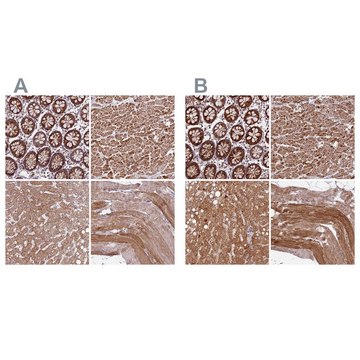 Anti-NDUFA8 antibody produced in rabbit Prestige Antibodies&#174; Powered by Atlas Antibodies, affinity isolated antibody, buffered aqueous glycerol solution