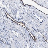 Anti-ACKR1 antibody produced in rabbit Prestige Antibodies® Powered by Atlas Antibodies, affinity isolated antibody, buffered aqueous glycerol solution