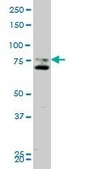 Monoclonal Anti-SMO, (C-terminal) antibody produced in mouse clone 1D9, purified immunoglobulin, buffered aqueous solution
