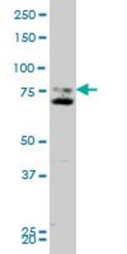 Monoclonal Anti-SMO, (C-terminal) antibody produced in mouse clone 1D9, purified immunoglobulin, buffered aqueous solution