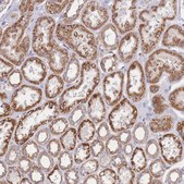 Anti-KIF16B antibody produced in rabbit Prestige Antibodies® Powered by Atlas Antibodies, affinity isolated antibody, buffered aqueous glycerol solution