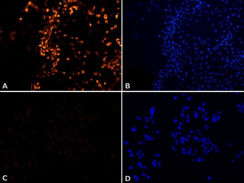 Anti-MNK2 (N-terminal) antibody produced in rabbit ~1.0&#160;mg/mL, affinity isolated antibody, buffered aqueous solution