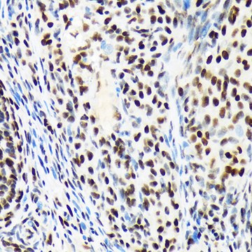 Anti-ARID1A Antibody, clone 9D4J6, Rabbit Monoclonal