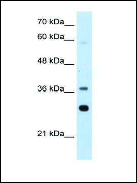 Anti-RPLP0 (AB2) antibody produced in rabbit IgG fraction of antiserum