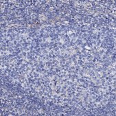 Anti-KLHL32 antibody produced in rabbit Prestige Antibodies® Powered by Atlas Antibodies, affinity isolated antibody, buffered aqueous glycerol solution
