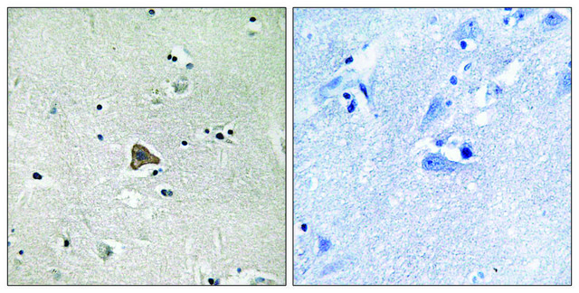 Anti-Claudin 4 antibody produced in rabbit affinity isolated antibody