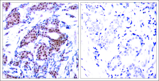 Anti-phospho-ELK1 (pSer383) antibody produced in rabbit affinity isolated antibody