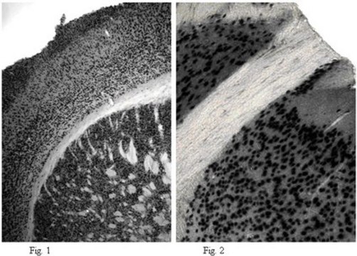 Anti-NeuN (rabbit) Antibody, Biotin Conjugate from rabbit, biotin conjugate