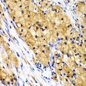 Anti-CAPG antibody produced in rabbit