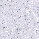 Monoclonal Anti-PNMT antibody produced in mouse Prestige Antibodies® Powered by Atlas Antibodies, clone CL11434, purified antibody (Protein A)