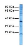 Anti-P2RX7 antibody produced in rabbit IgG fraction of antiserum
