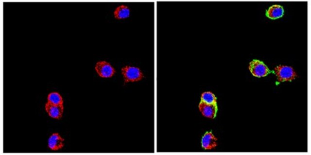 Anti-Neural Cell Adhesion Molecule L1 Antibody, clone 324 clone 324, Chemicon&#174;, from rat