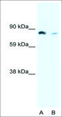 Anti-NFKB2 (AB2) antibody produced in rabbit affinity isolated antibody