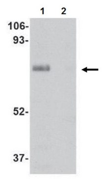 Anti-LIMP II Antibody from rabbit, purified by affinity chromatography