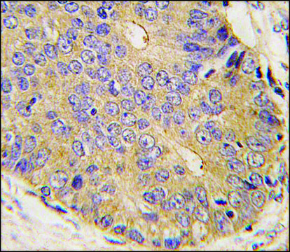 Anti-Bmp15 (N-term) antibody produced in rabbit IgG fraction of antiserum, buffered aqueous solution