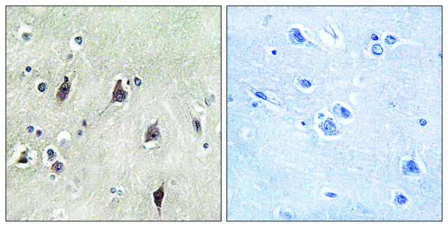 Anti-p70 S6 Kinase antibody produced in rabbit affinity isolated antibody