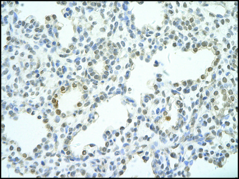 Anti-UTP18 antibody produced in rabbit affinity isolated antibody