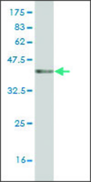 Monoclonal Anti-K6HF antibody produced in mouse clone 2E3, ascites fluid