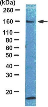 Anti-IRS1 Antibody Upstate&#174;, from rabbit