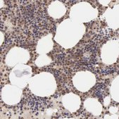 Anti-BID antibody produced in rabbit Prestige Antibodies® Powered by Atlas Antibodies, affinity isolated antibody, buffered aqueous glycerol solution
