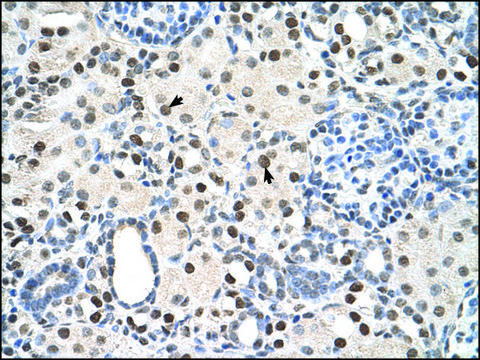 Anti-PSME3 (AB1) antibody produced in rabbit affinity isolated antibody