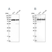 Anti-DDX1 antibody produced in rabbit Prestige Antibodies® Powered by Atlas Antibodies, affinity isolated antibody, buffered aqueous glycerol solution
