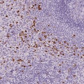 Anti-CXCR2 antibody produced in rabbit Prestige Antibodies® Powered by Atlas Antibodies, affinity isolated antibody, buffered aqueous glycerol solution