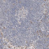 Anti-CMTM4 antibody produced in rabbit Prestige Antibodies® Powered by Atlas Antibodies, affinity isolated antibody, buffered aqueous glycerol solution