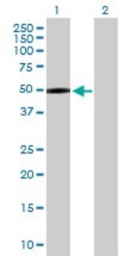 Anti-MASP1 antibody produced in rabbit purified immunoglobulin, buffered aqueous solution