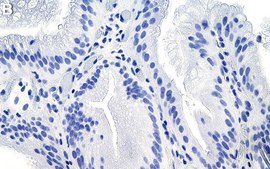 Anti-CTBP2 Antibody, clone 1C2 ZooMAb® Rabbit Monoclonal recombinant, expressed in HEK 293 cells