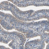 Anti-TPBG antibody produced in rabbit Prestige Antibodies® Powered by Atlas Antibodies, affinity isolated antibody, buffered aqueous glycerol solution