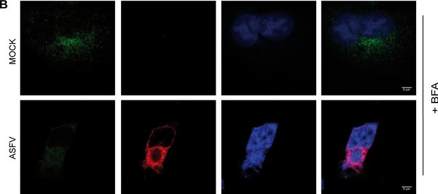 Monoclonal Anti-&#947;-Adaptin antibody produced in mouse clone 100/3, ascites fluid