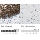 Anti-DSC2 antibody produced in rabbit Prestige Antibodies® Powered by Atlas Antibodies, affinity isolated antibody, buffered aqueous glycerol solution
