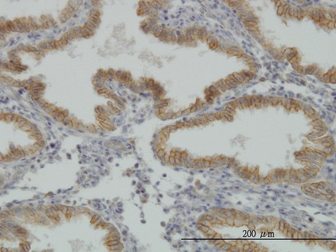 Monoclonal Anti-MUSK antibody produced in mouse clone 2H6, purified immunoglobulin, buffered aqueous solution