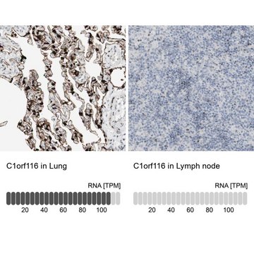 Anti-C1orf116 antibody produced in rabbit Prestige Antibodies&#174; Powered by Atlas Antibodies, affinity isolated antibody, buffered aqueous glycerol solution