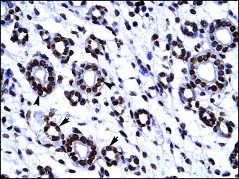 Anti-HES1 IgG fraction of antiserum