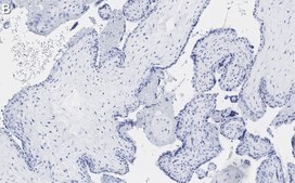 Anti-MOSPD2 Antibody, clone 3C20 ZooMAb® Rabbit Monoclonal recombinant, expressed in HEK 293 cells