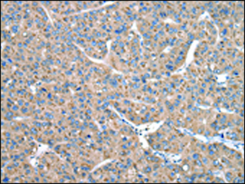 Anti-CASK affinity isolated antibody